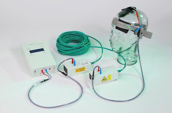 تی دی سی اس (TDCS) چیست؟