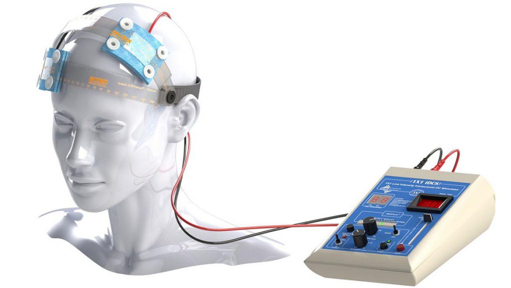 کاربرد دستگاه tDCS در درمان چیست؟