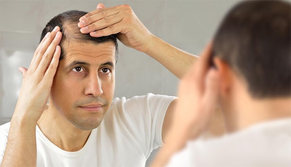 Hair disordere