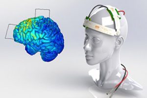 مرکز خوب تحریک الکتریکی مغز در مشهد