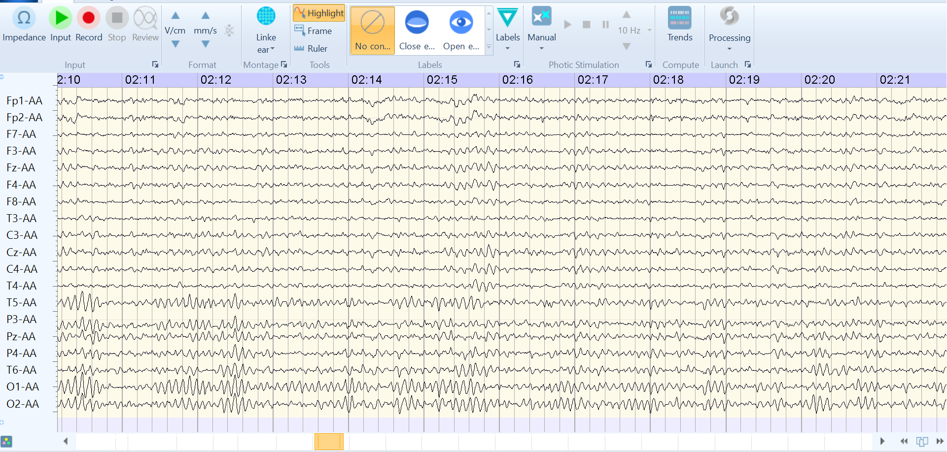 EEG 1