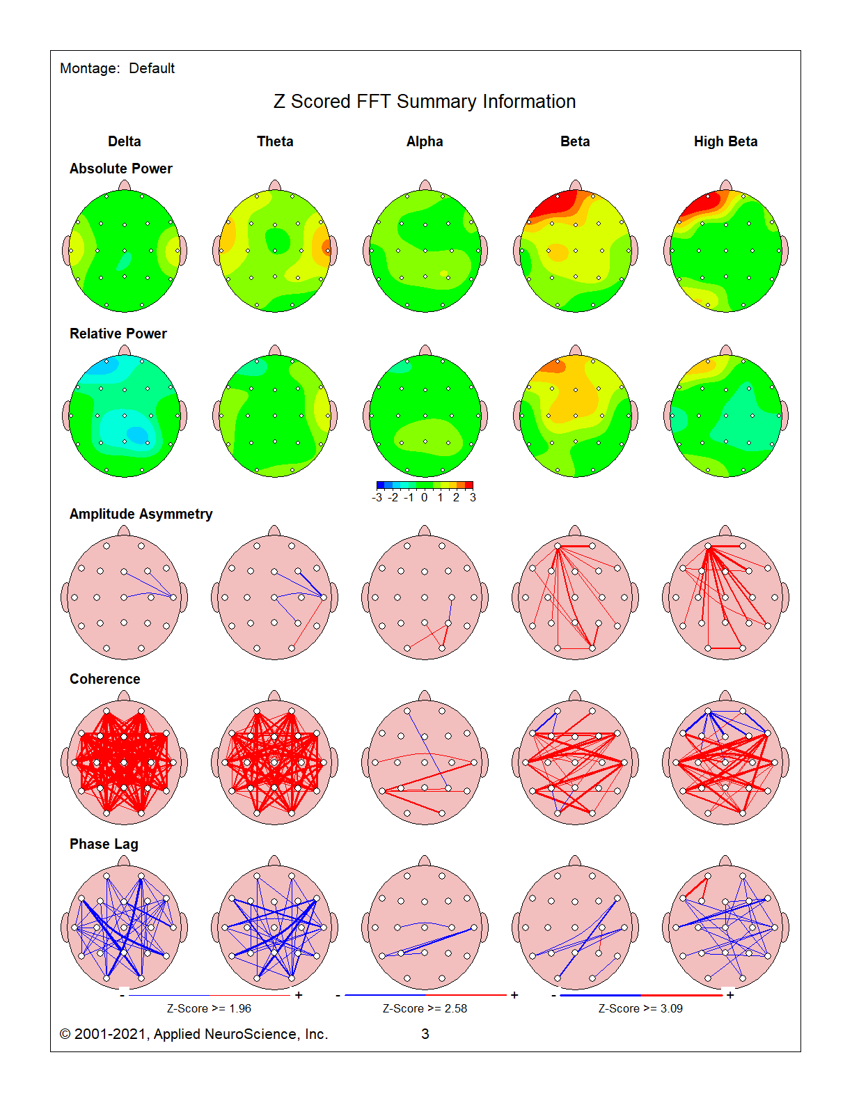 qeeg1 ec 3