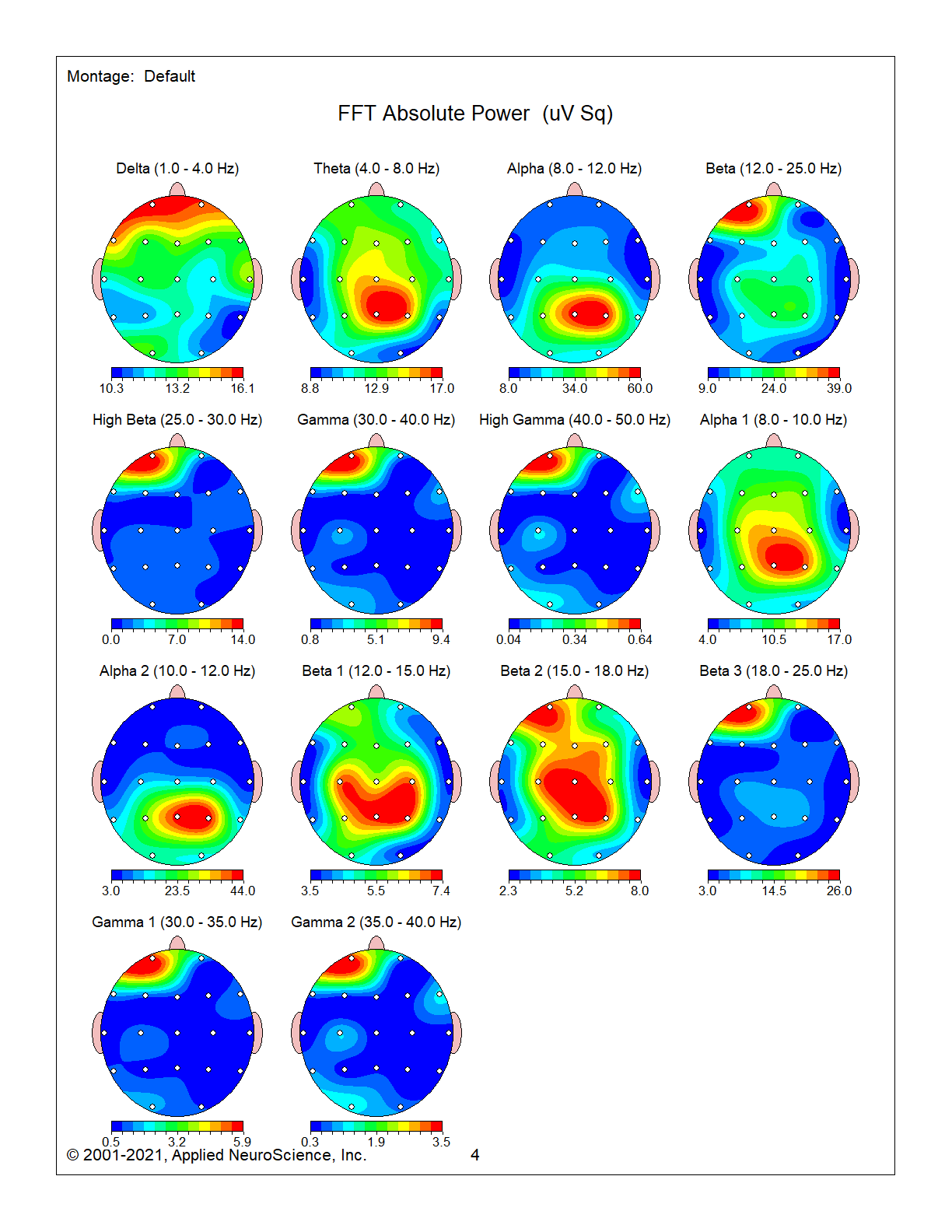 qeeg1 ec 4