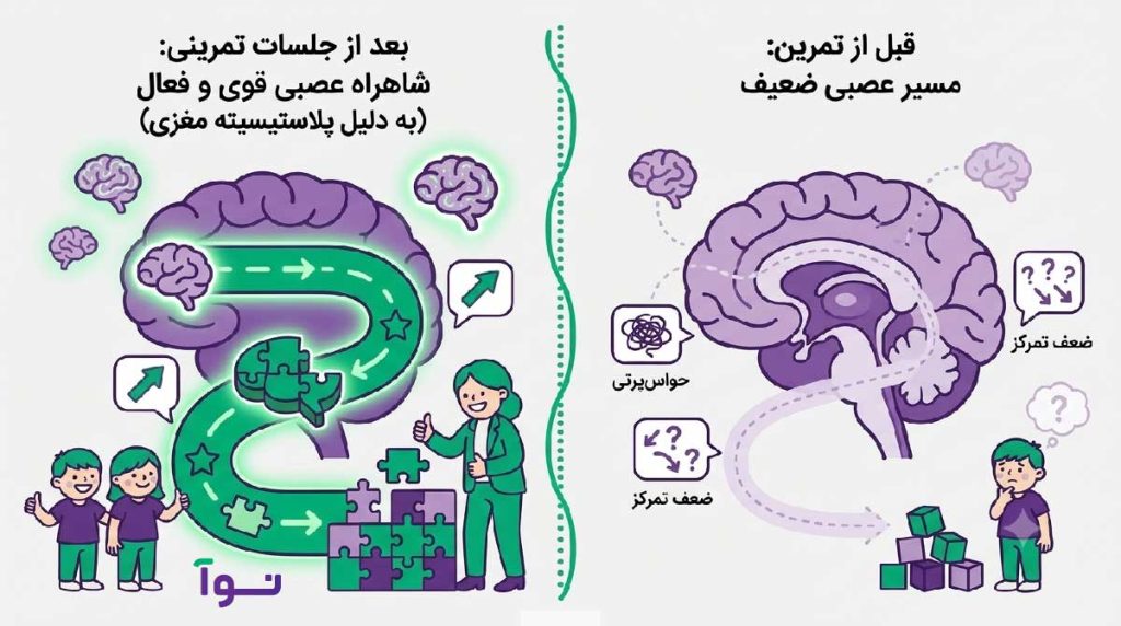 مقایسه قبل و بعد از نوروفیدبک در پلاستیسیته مغزی
